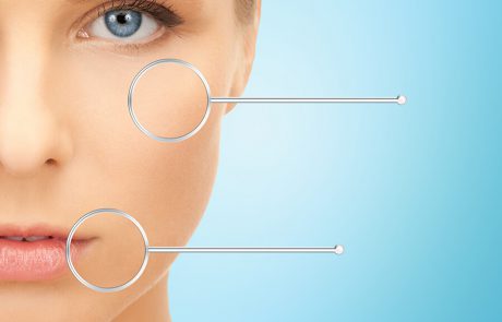 איזה סוג עור יש לי?